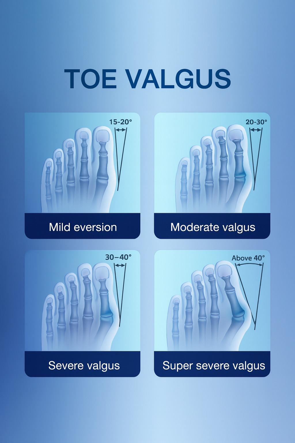 AlignaToe – conveys alignment and correction